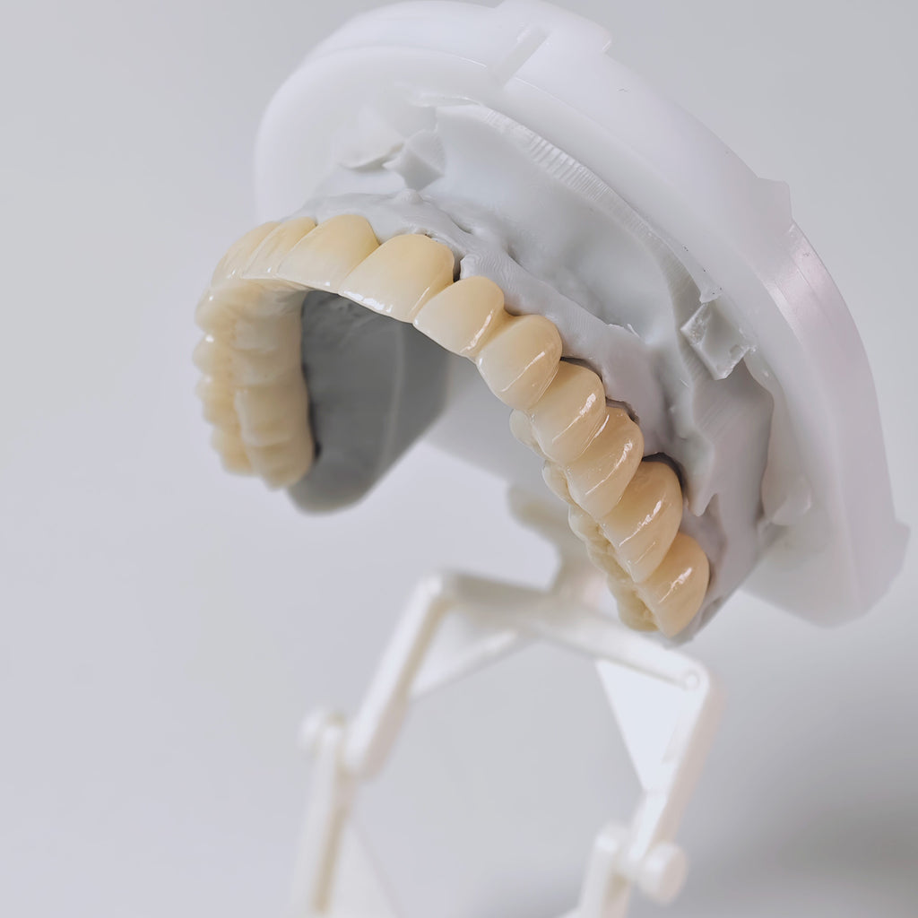 Ti-Bar Titanium Nitride Metal Frame With Zirconia Bridge And Cement Retained