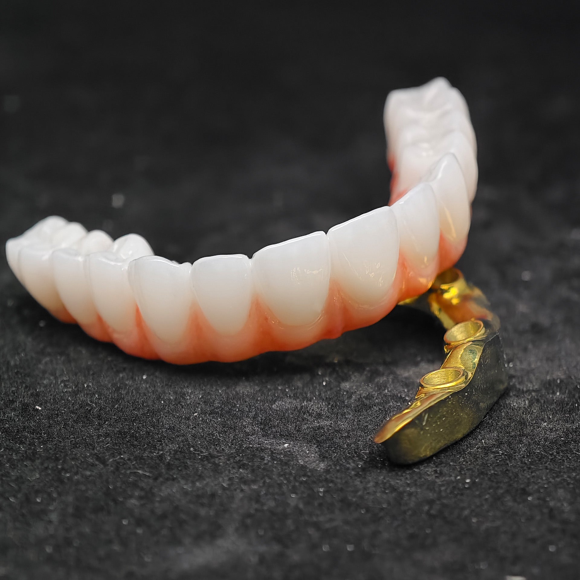 Ti-Bar Titanium Nitride Metal Frame With Zirconia Bridge For Full Arch Restoration