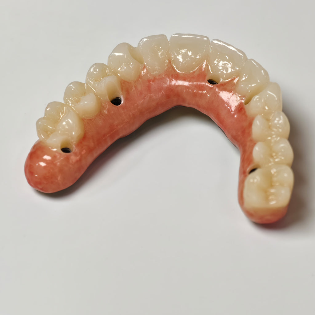 Ti-Bar Titanium Nitride Metal Frame With Zirconia Bridge For Full Arch Restoration