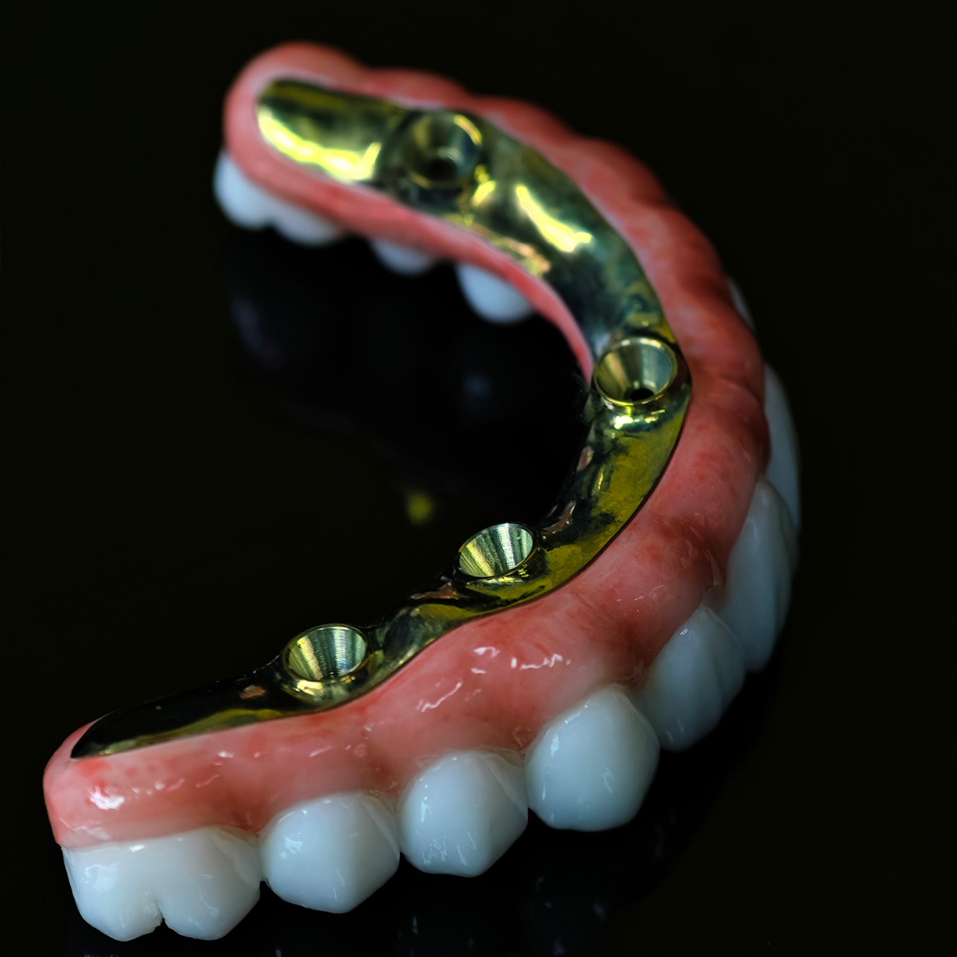 Ti-Bar Titanium Nitride Metal Frame With Zirconia Bridge For Full Arch Restoration