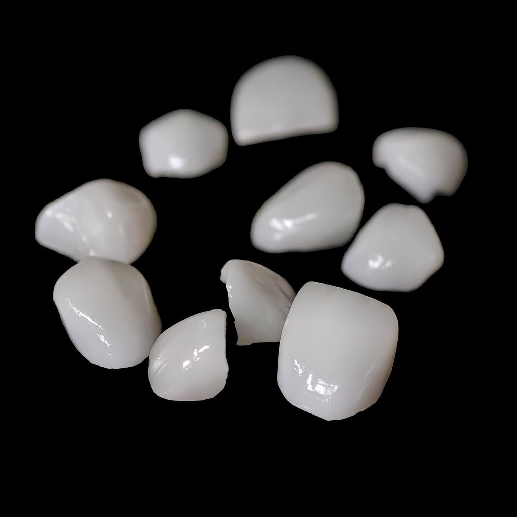 Ultra-Thin Emax Veneer. High Transparency/Translucent, Natural Shade