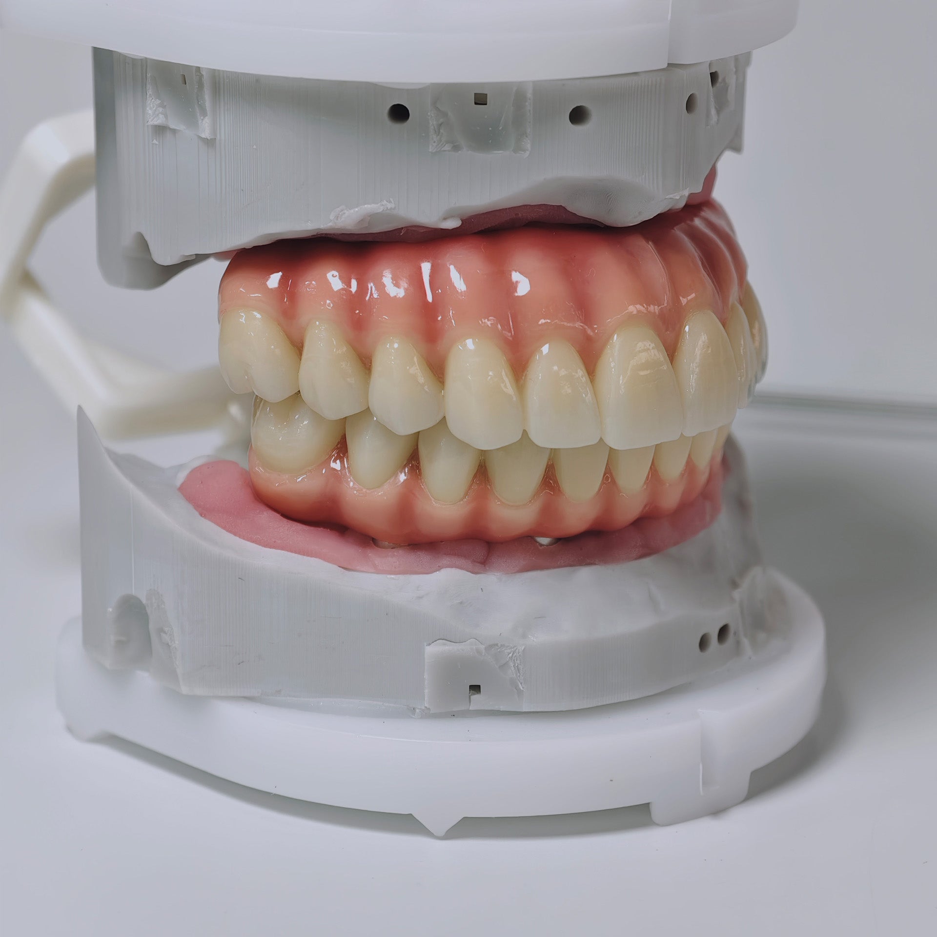Zirconia-Enamel Hybrid Malo Bridge