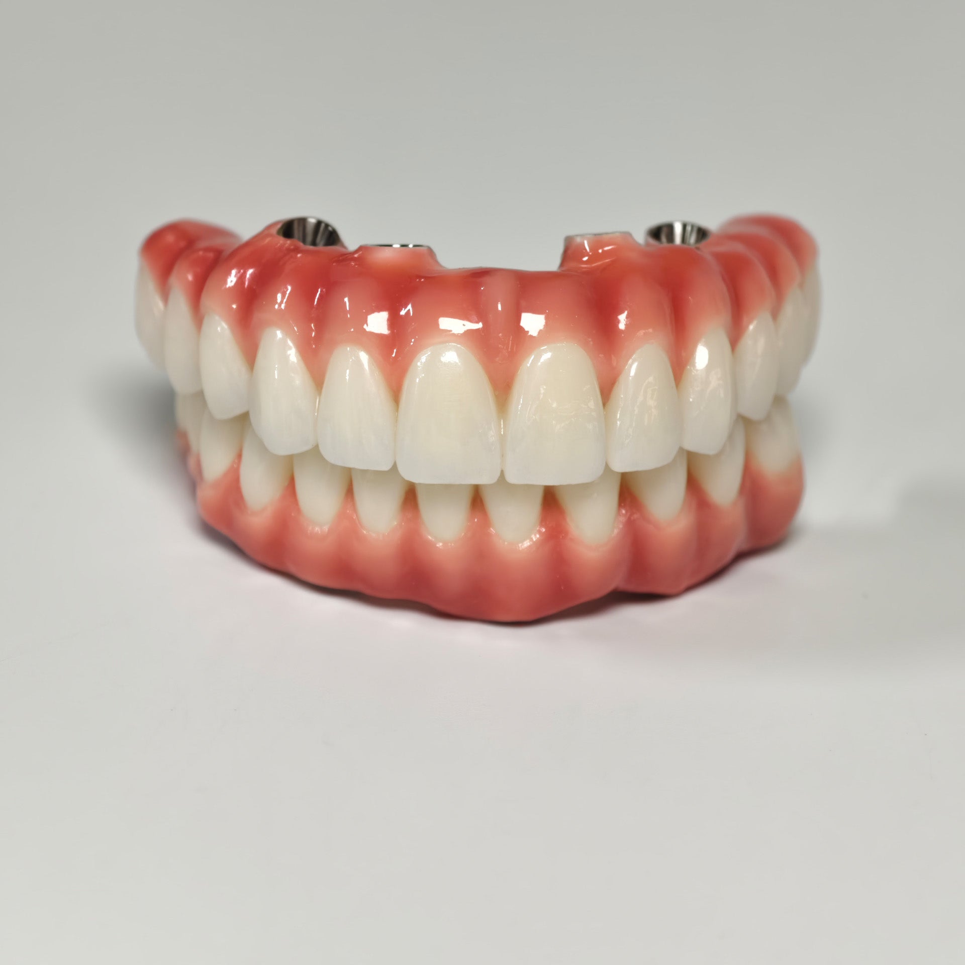 Zirconia-Enamel Hybrid Malo Bridge