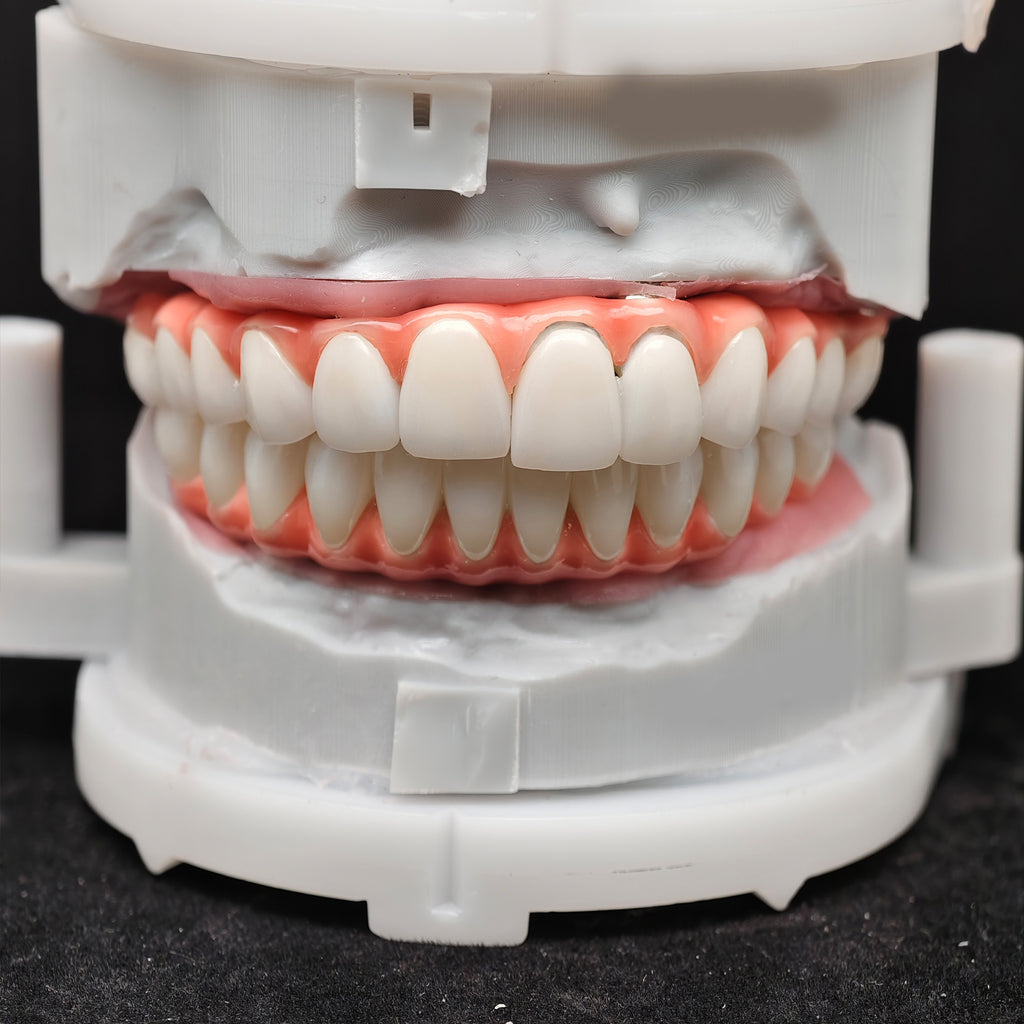 Zirconia-Enamel Hybrid Malo Bridge