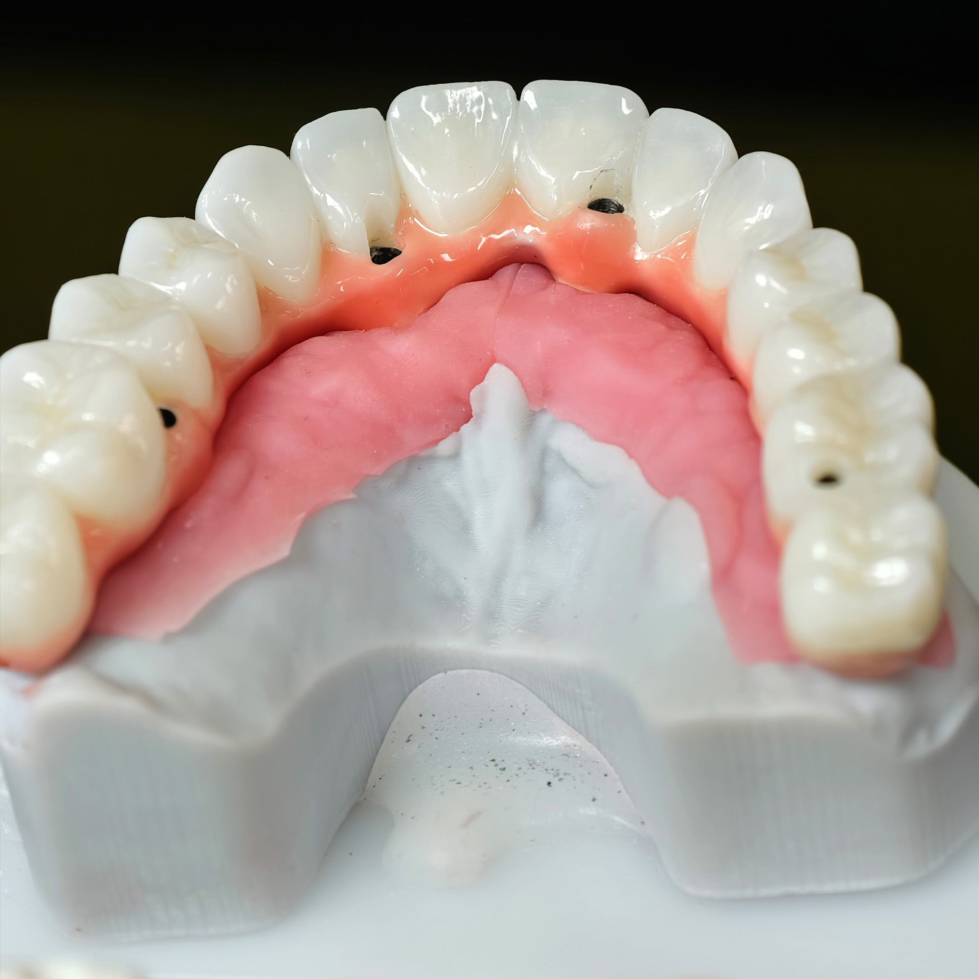Zirconia-Enamel Hybrid Malo Bridge