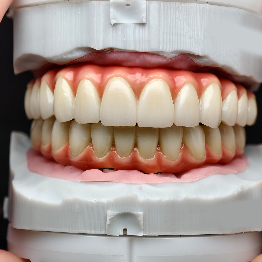 Zirconia-Enamel Hybrid Malo Bridge