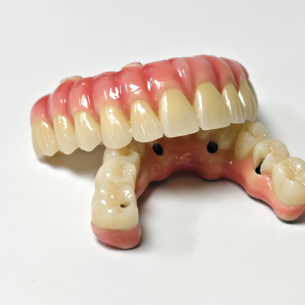 Zirconia-Enamel Hybrid Malo Bridge