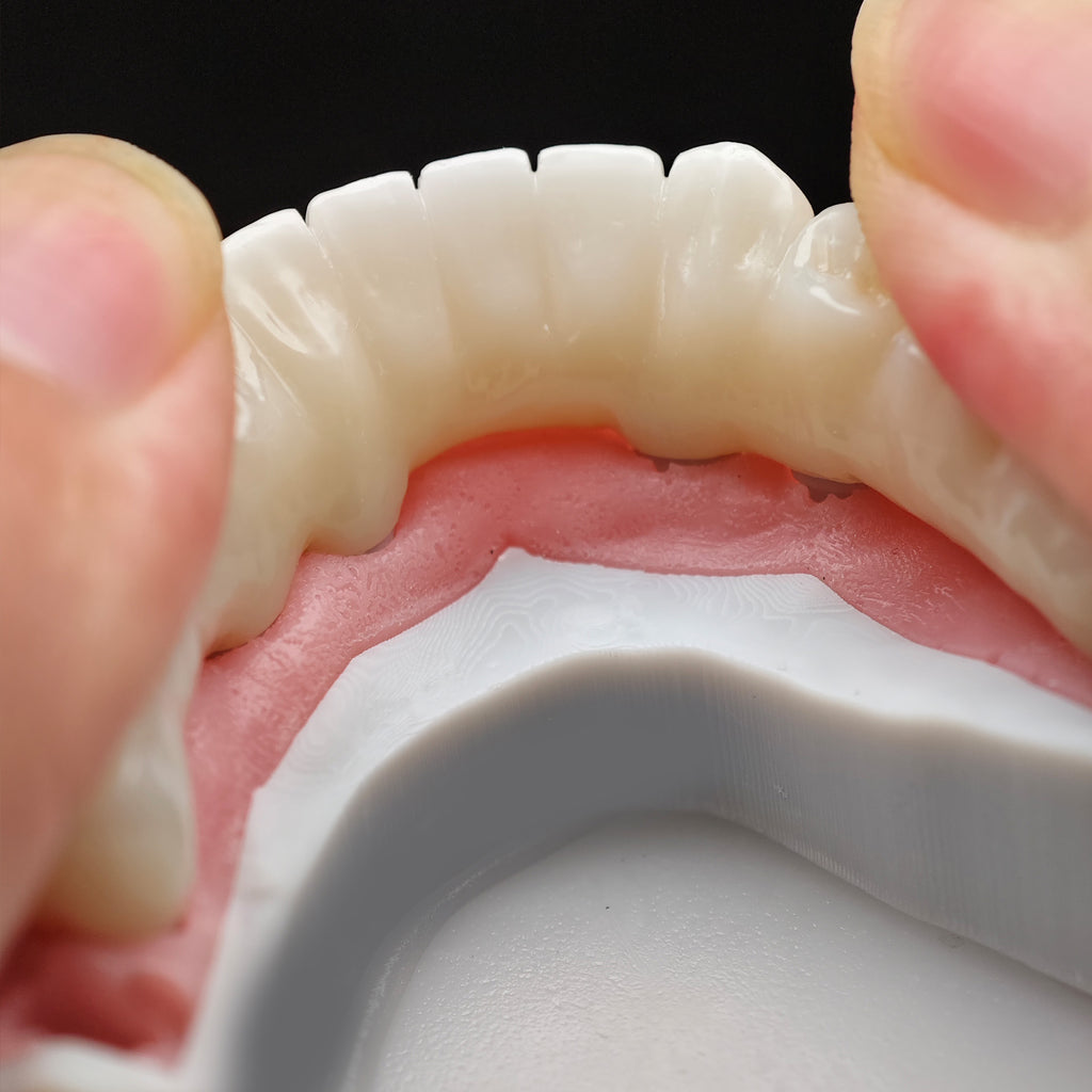 Zirconia Bridge With Cement Retained