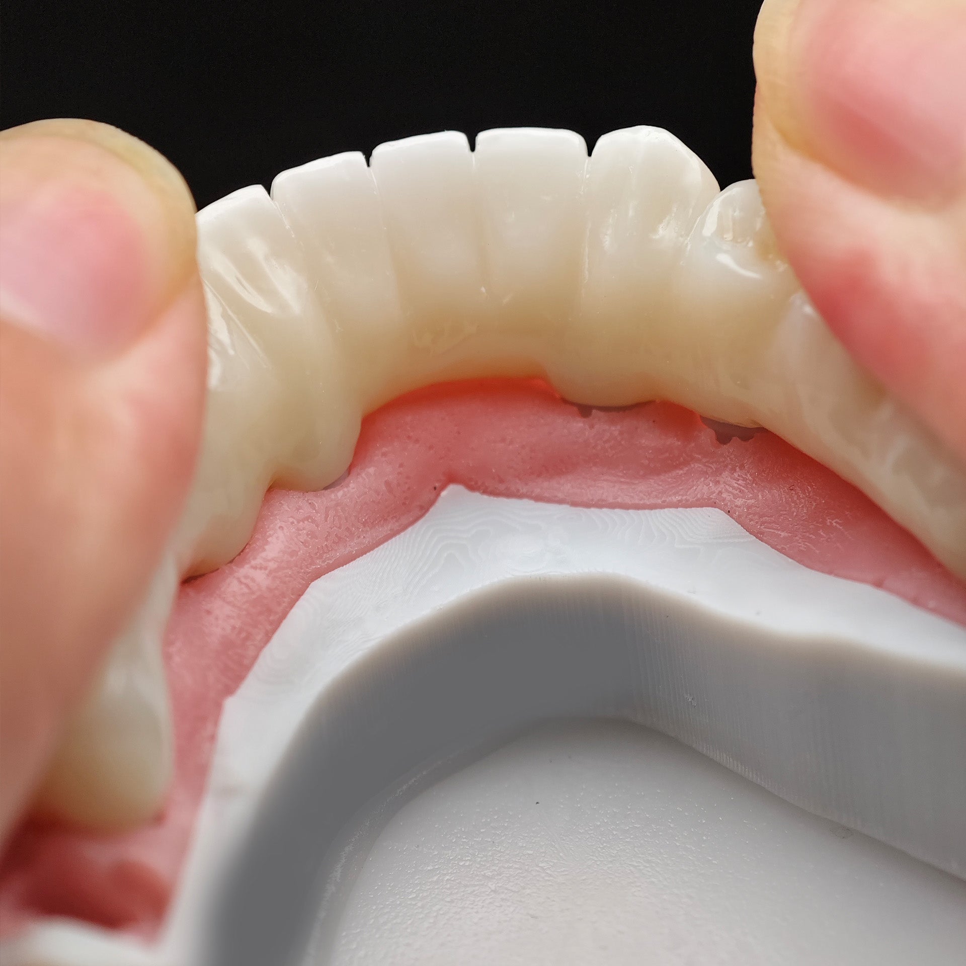 Zirconia Bridge With Cement Retained