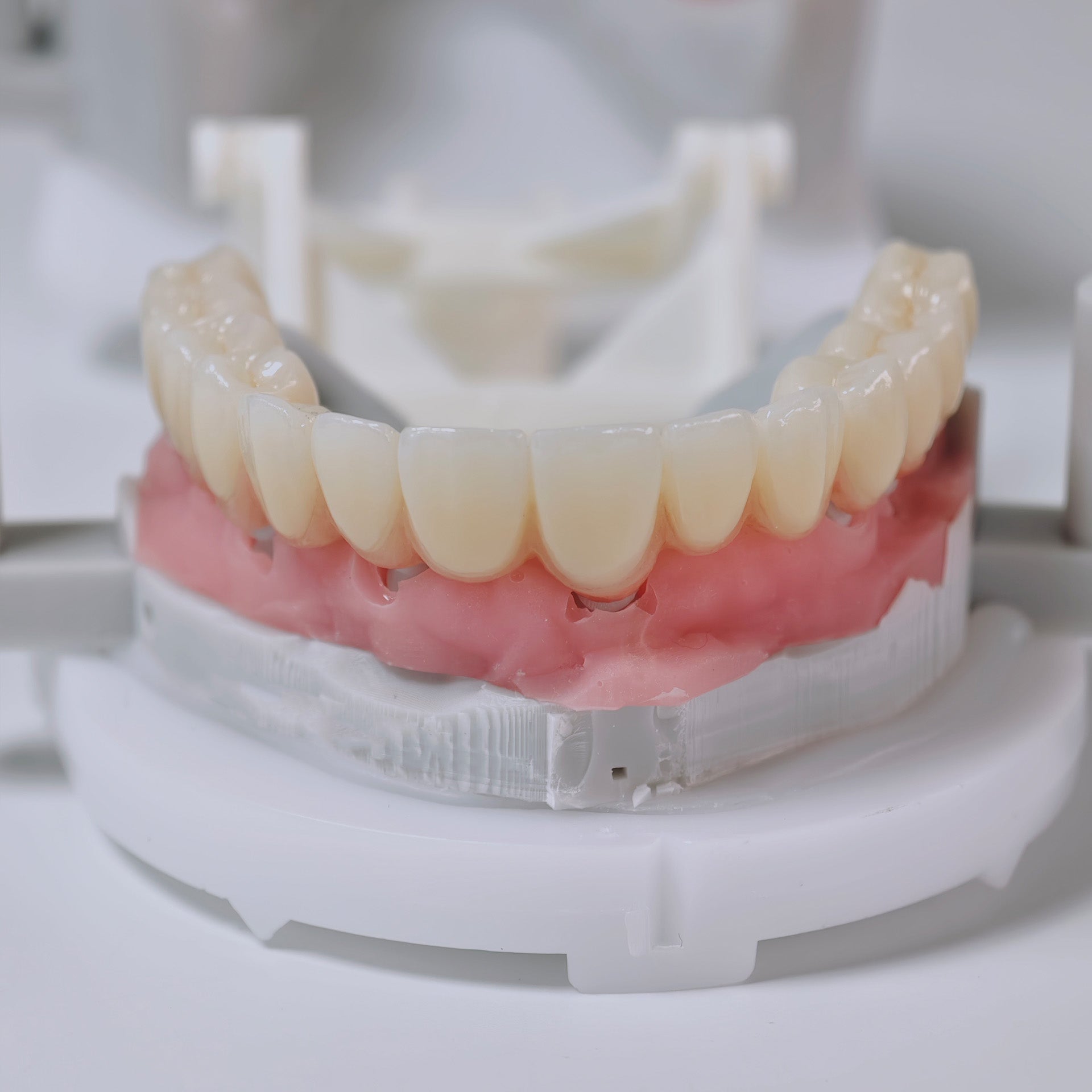 Zirconia Implant Bridges Screwmentable Dental Crown