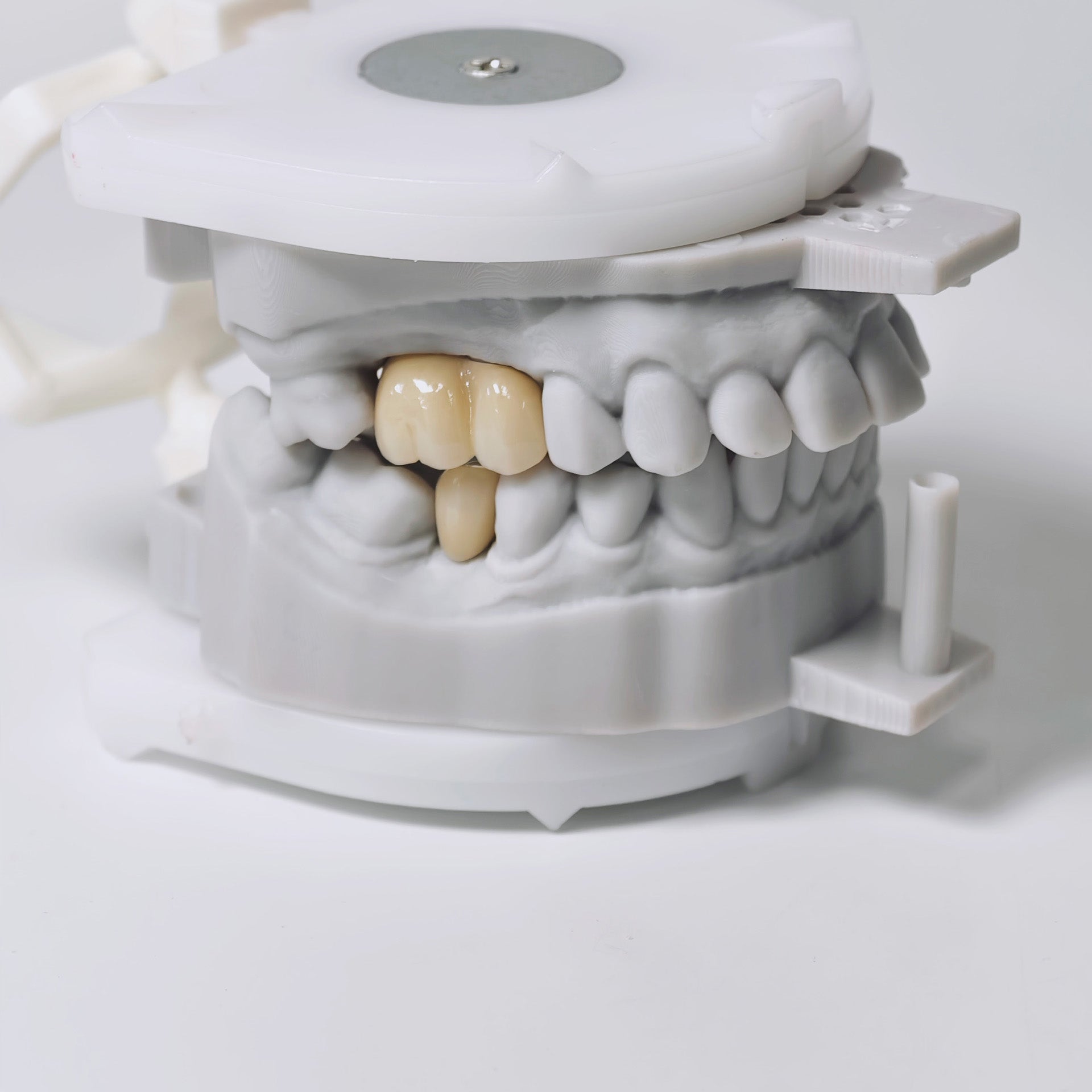 Zirconia Implant Crowns And Bridges Screwmentable Dental Crown