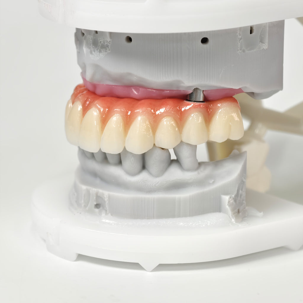 All On 5 Zirconia Bridge With Ti-Base Screw Retained