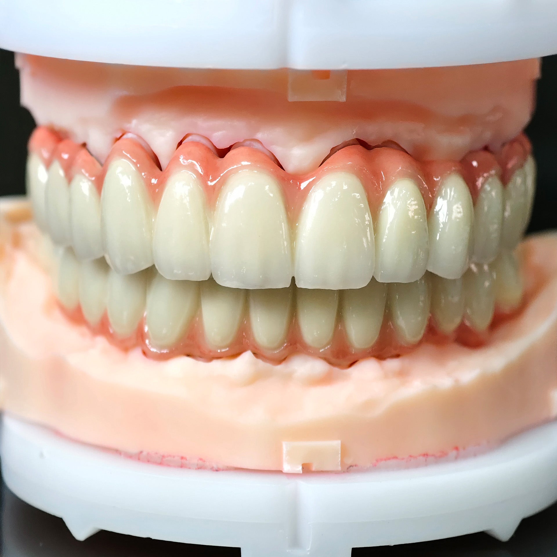 Co - Cr PFM Dental Bridge