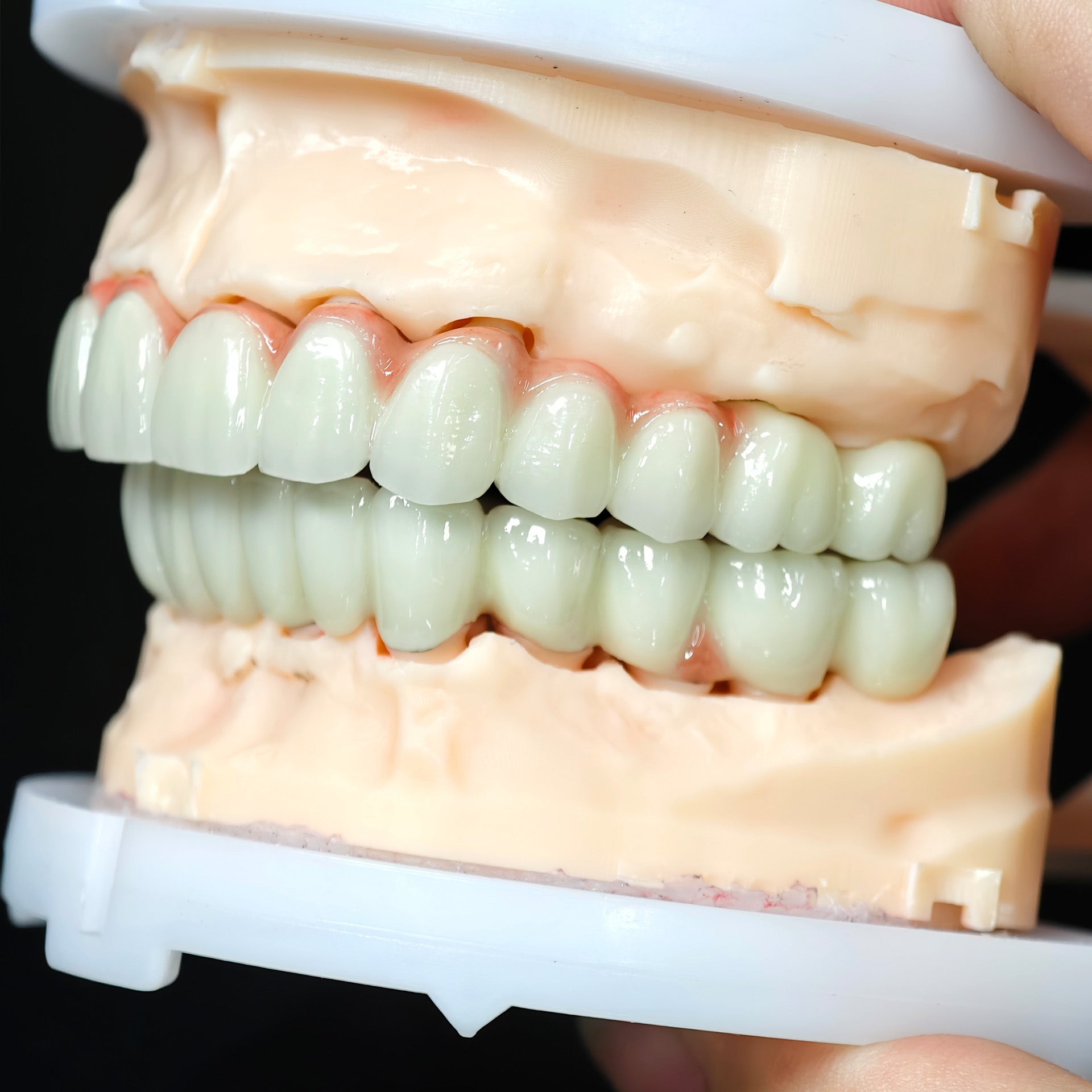 Co - Cr PFM Dental Bridge