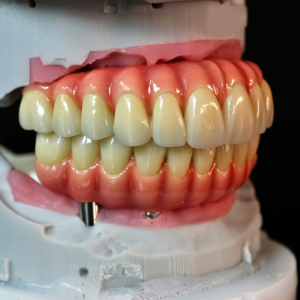 Enhanced Zirconia Crown Malo Bridge