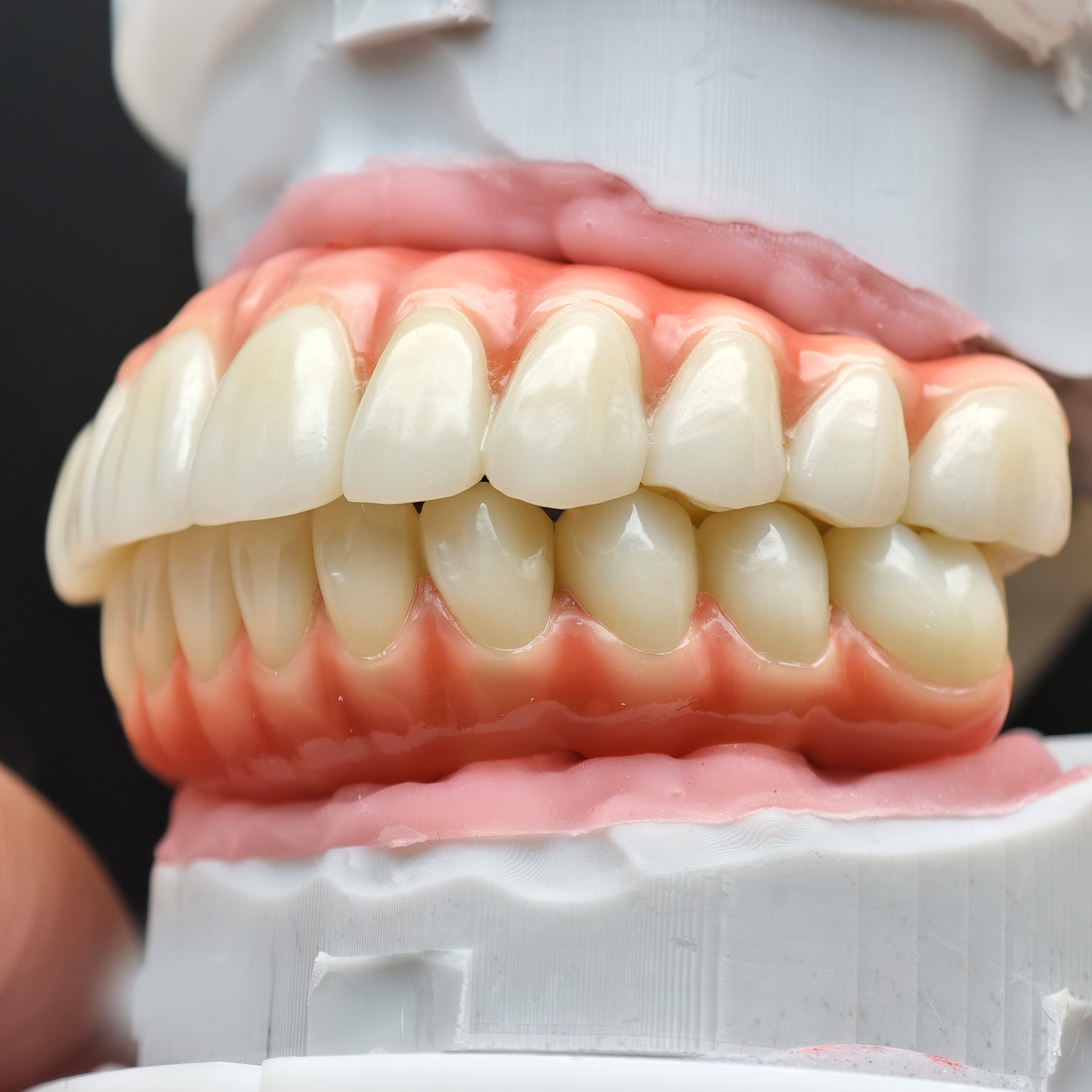 Enhanced Zirconia Crown Malo Bridge