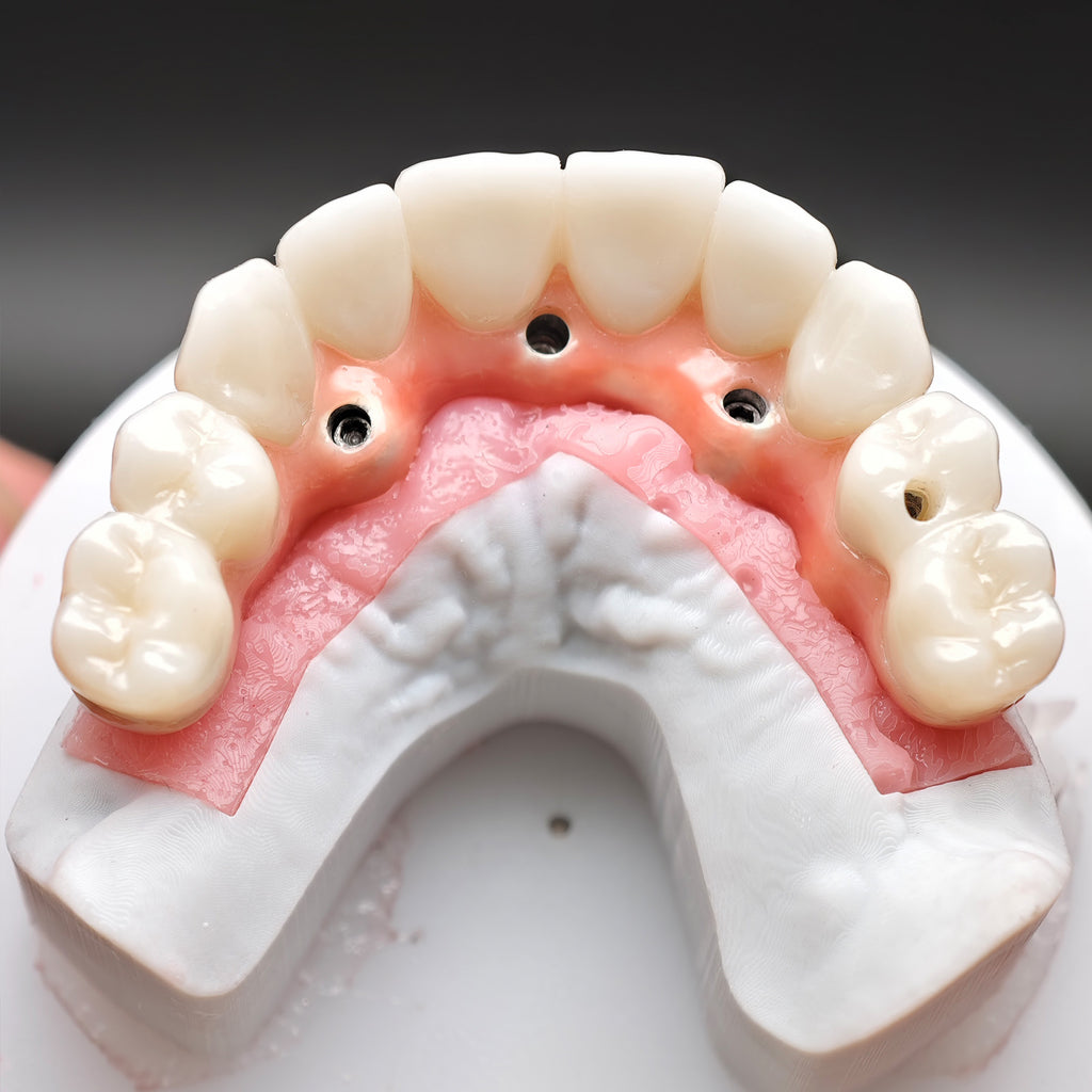 Enhanced Zirconia Crown Malo Bridge