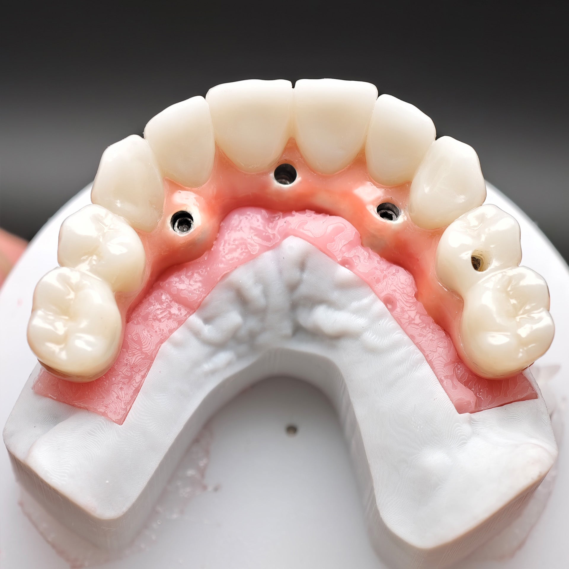 Enhanced Zirconia Crown Malo Bridge