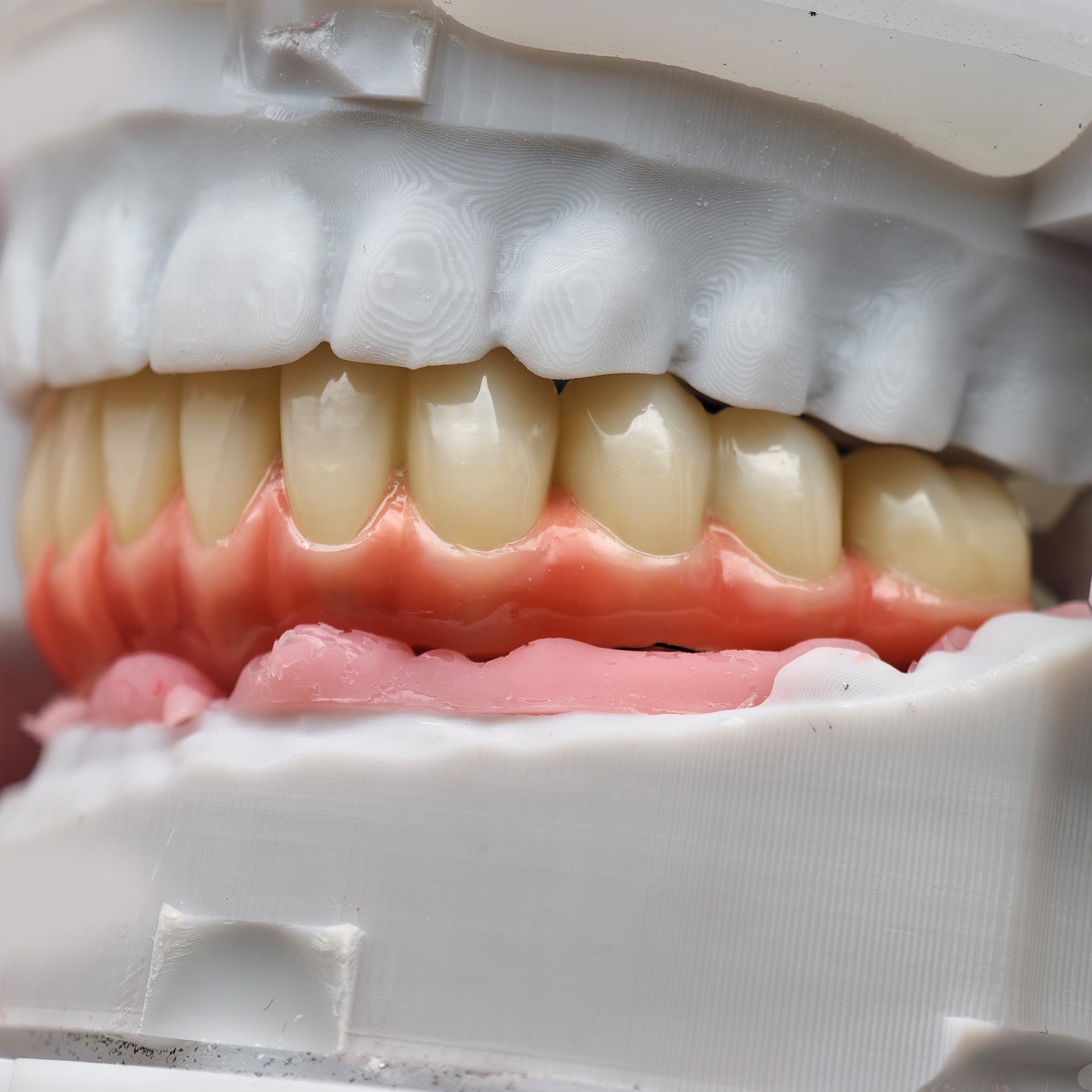 Enhanced Zirconia Crown Malo Bridge