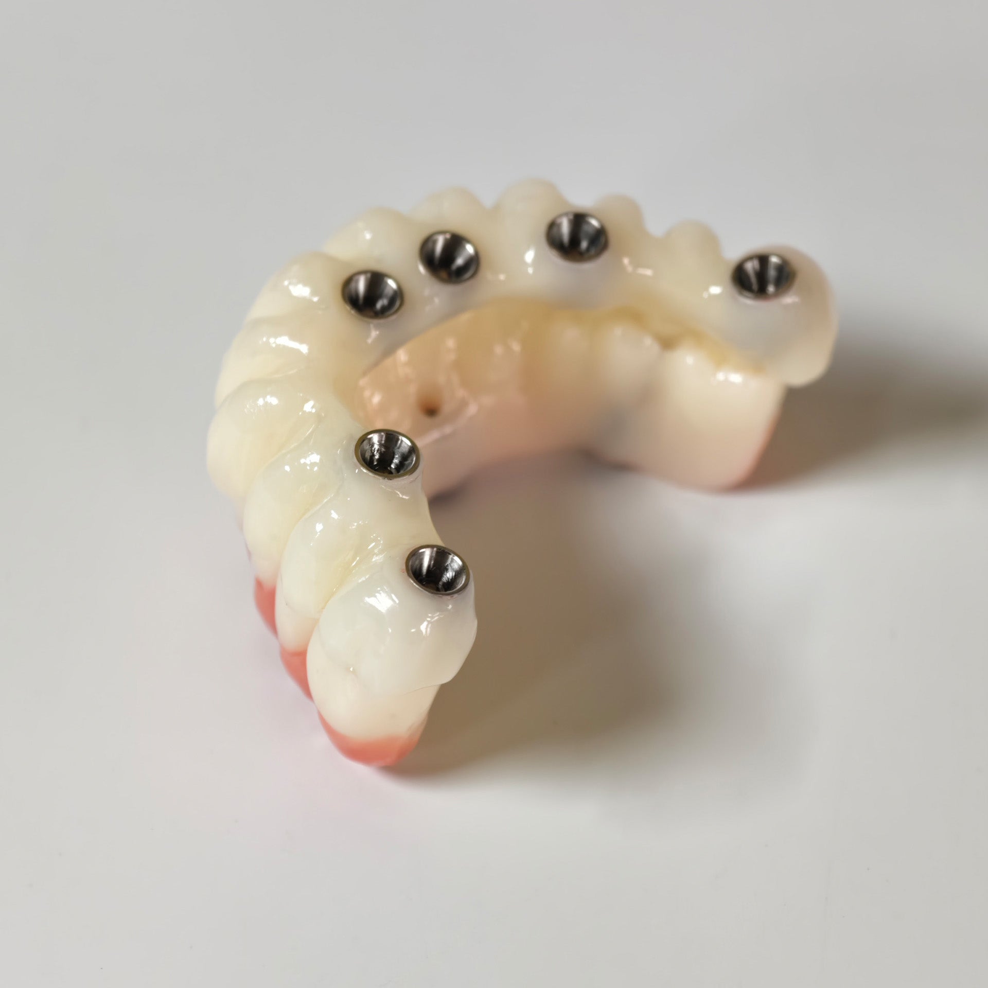 Full-Arch PMMA Bridge With Ti-Base Screw Retained