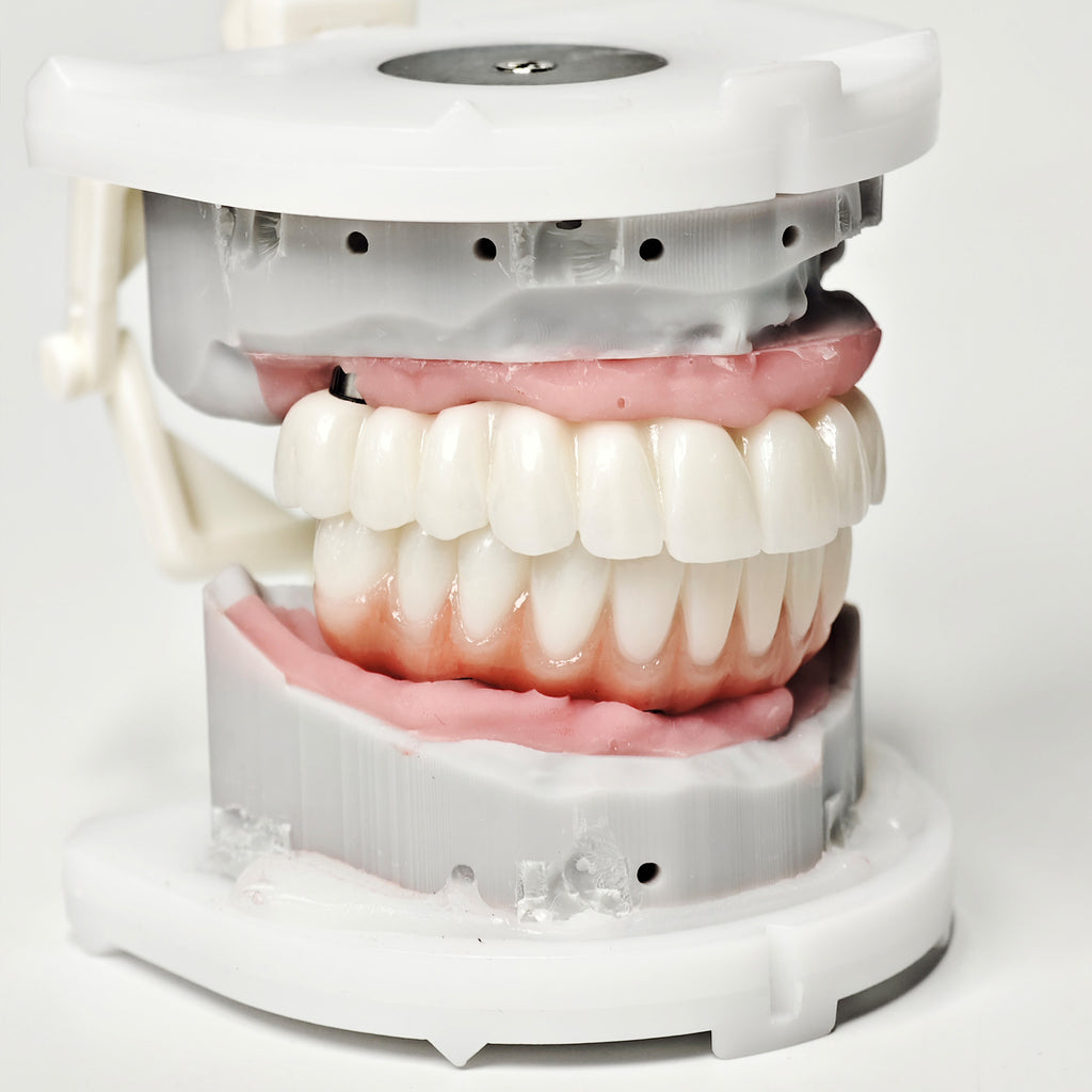 Full-Arch Zirconia Bridge With Ti-Base Abutment