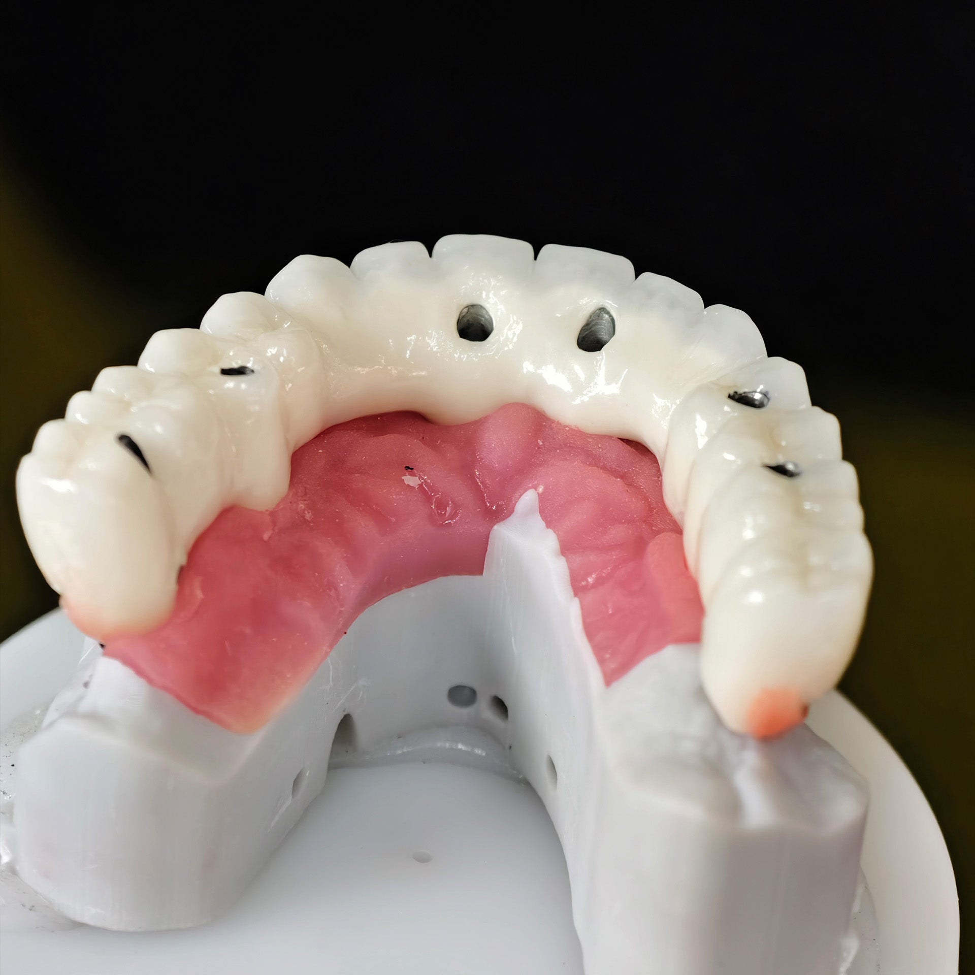 Implant-supported Co - Cr PFM Dental Bridge
