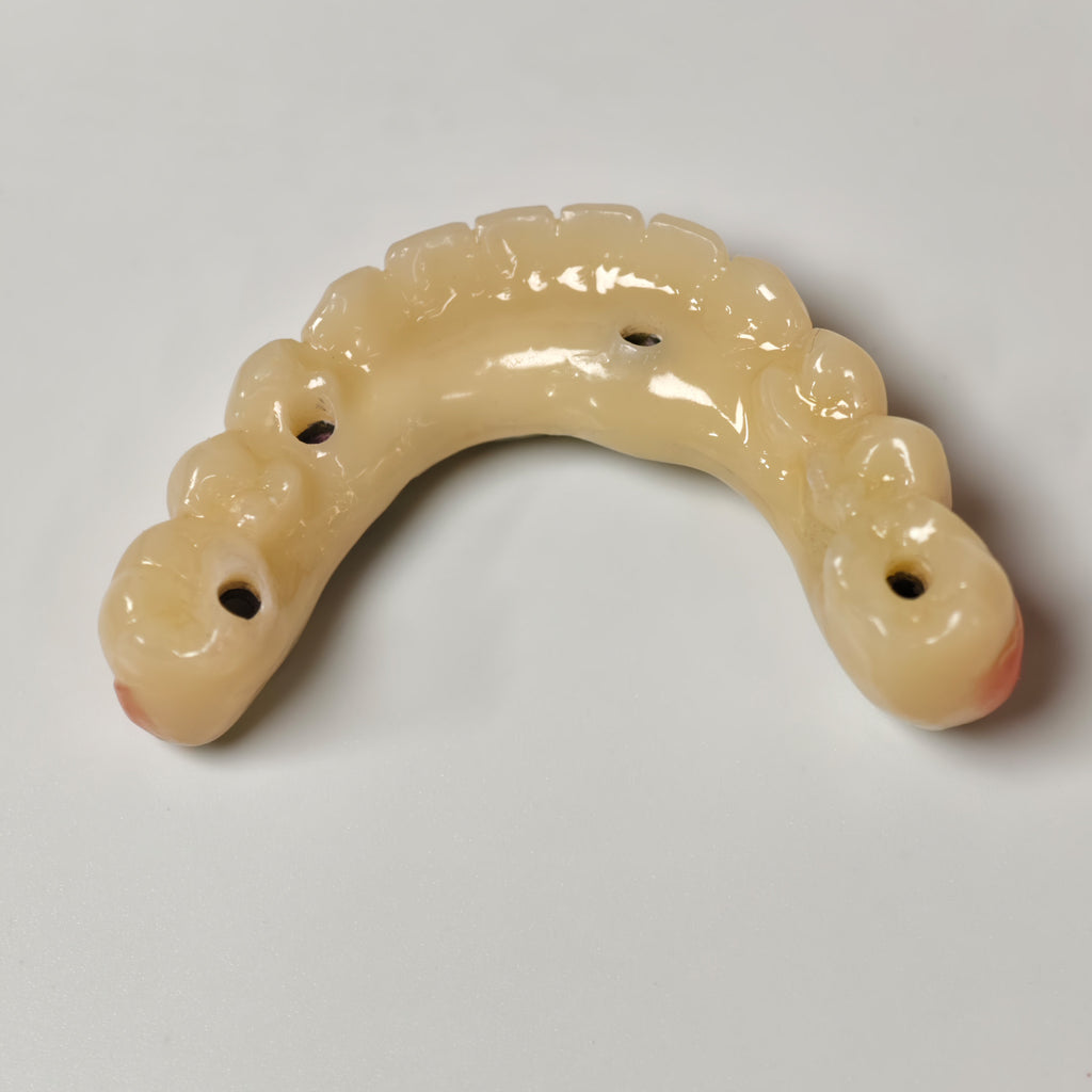 Ti-Bar Titanium Nitride Metal Frame With Zirconia Bridge For Full Arch Restoration