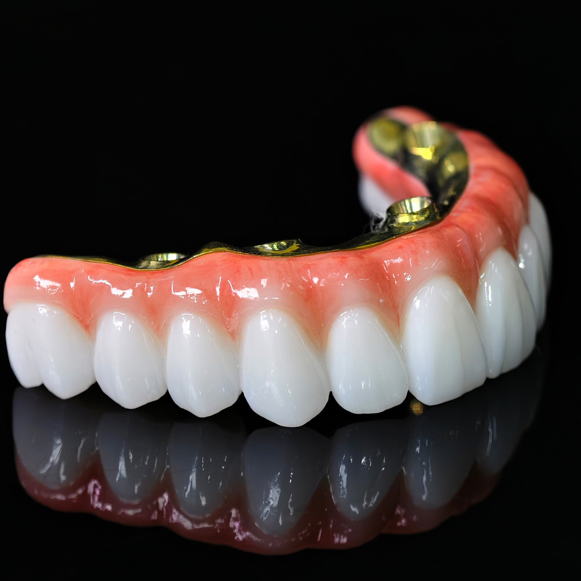 Ti-Bar Titanium Nitride Metal Frame With Zirconia Bridge For Full Arch Restoration