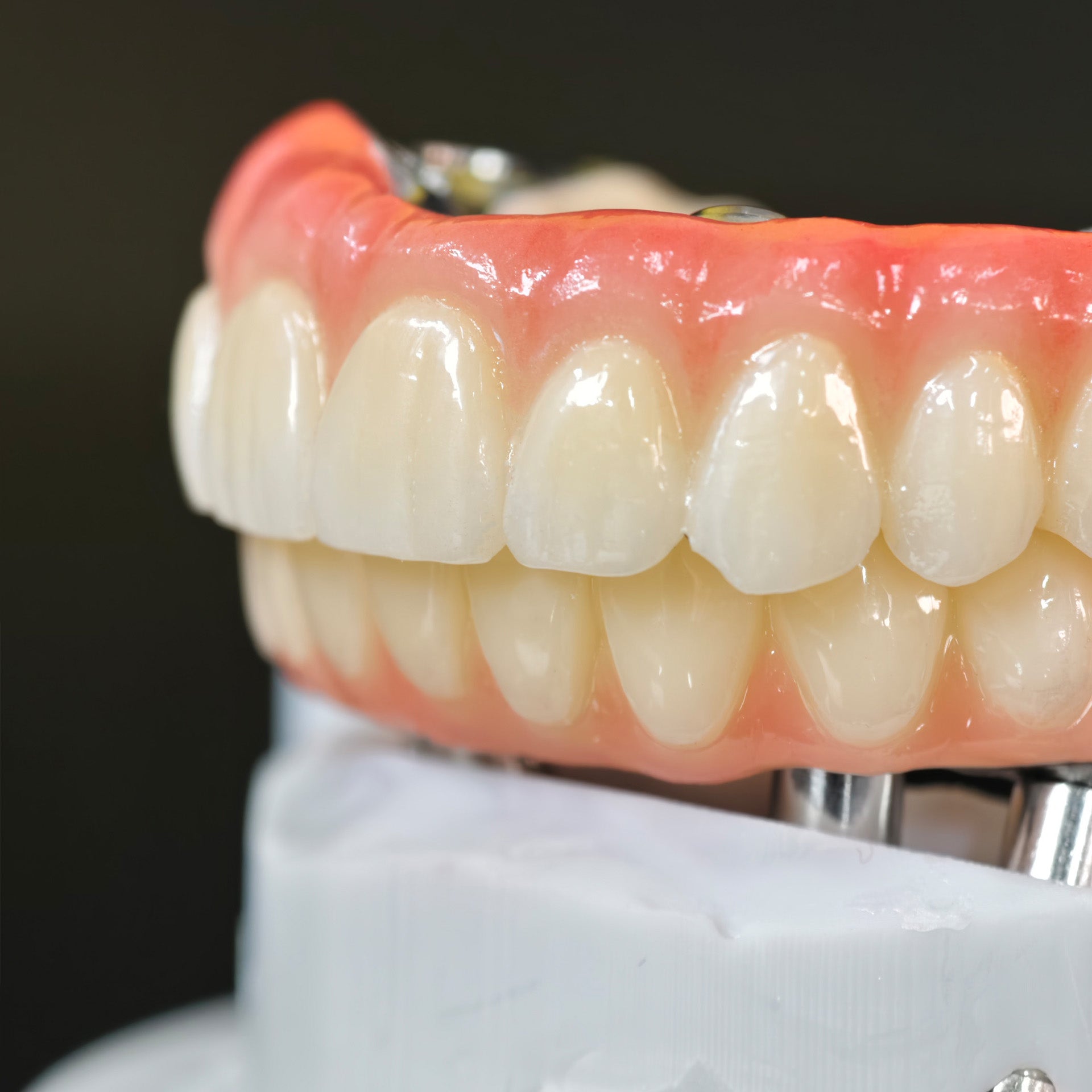 Ti-Bar Titanium Nitride Metal Frame With Zirconia Bridge For Full Arch Restoration
