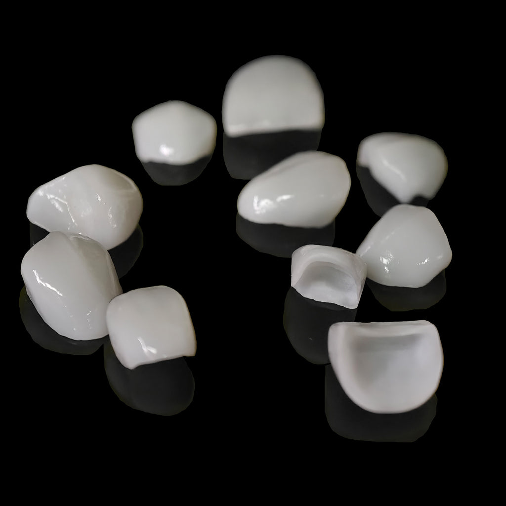 Ultra-Thin Emax Veneer. High Transparency/Translucent, Natural Shade