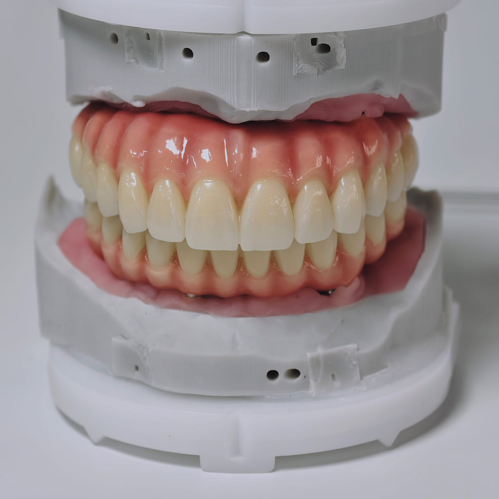 Zirconia-Enamel Hybrid Malo Bridge