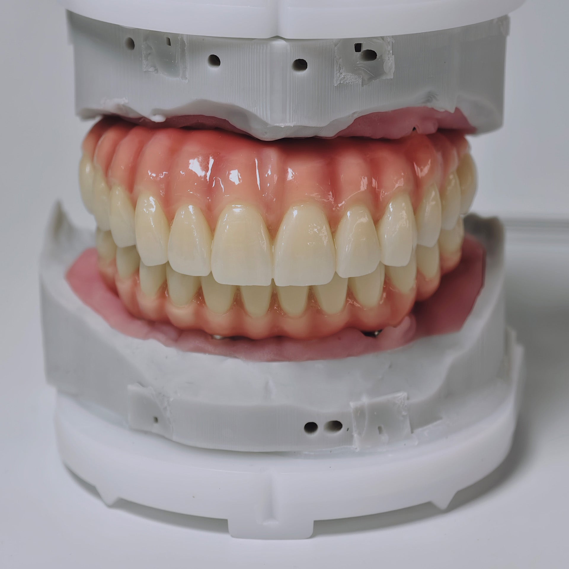 Zirconia-Enamel Hybrid Malo Bridge