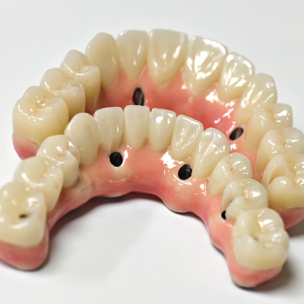 Zirconia-Enamel Hybrid Malo Bridge