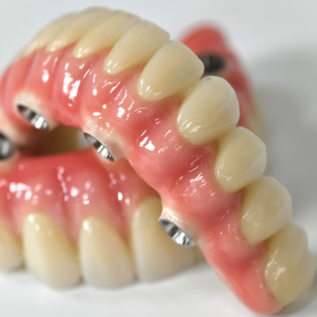 Zirconia-Enamel Hybrid Malo Bridge