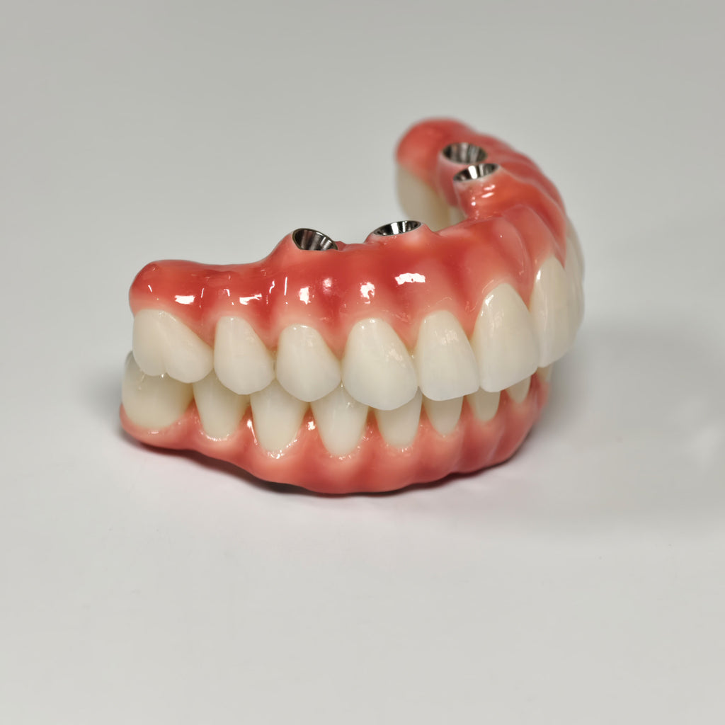Zirconia-Enamel Hybrid Malo Bridge