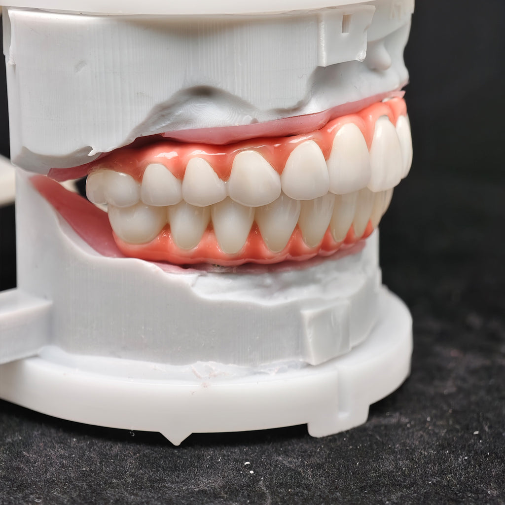 Zirconia-Enamel Hybrid Malo Bridge