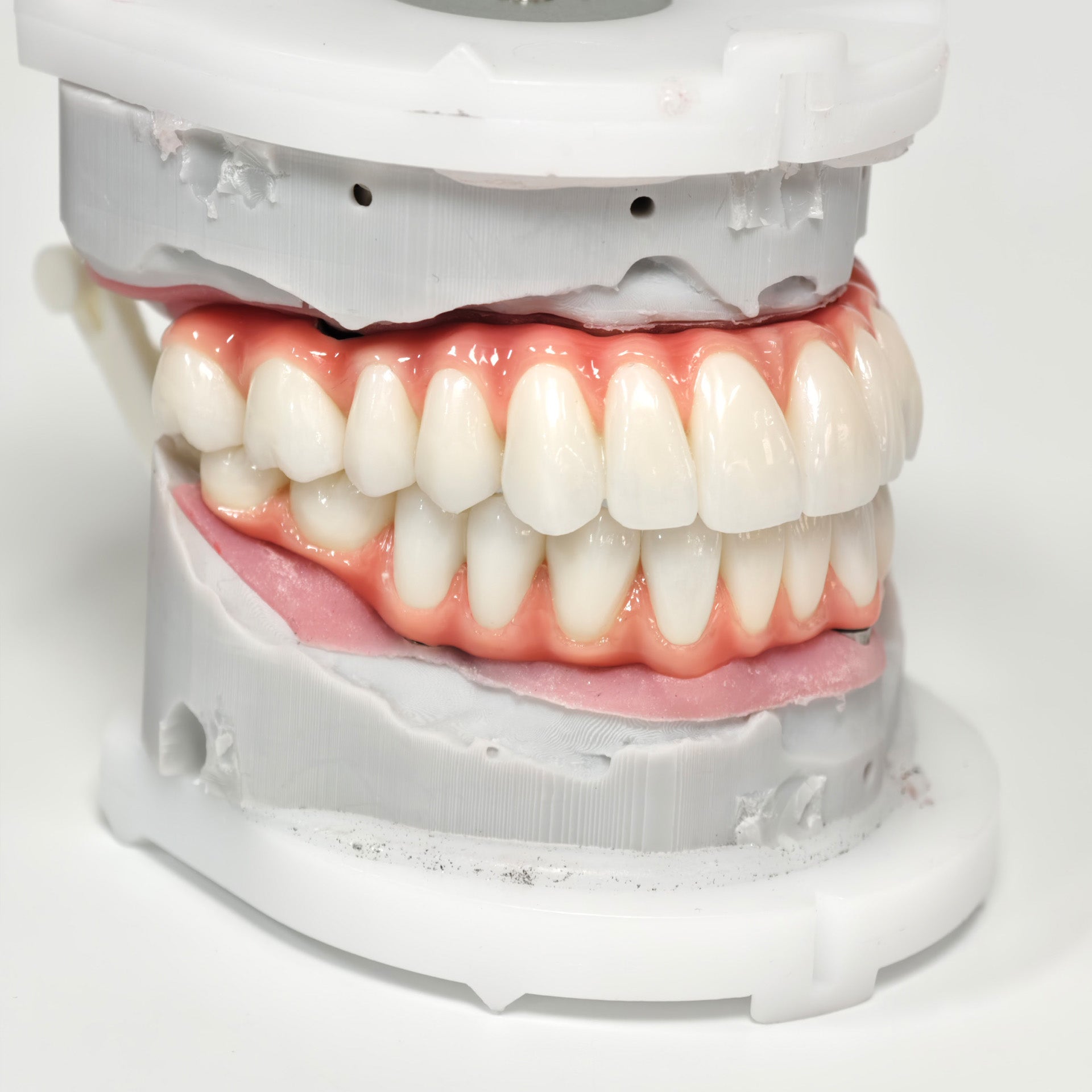 Zirconia-Enamel Hybrid Malo Bridge