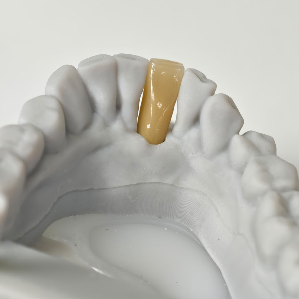 Zirconia Implant Bridge Screwmentable Dental Crown
