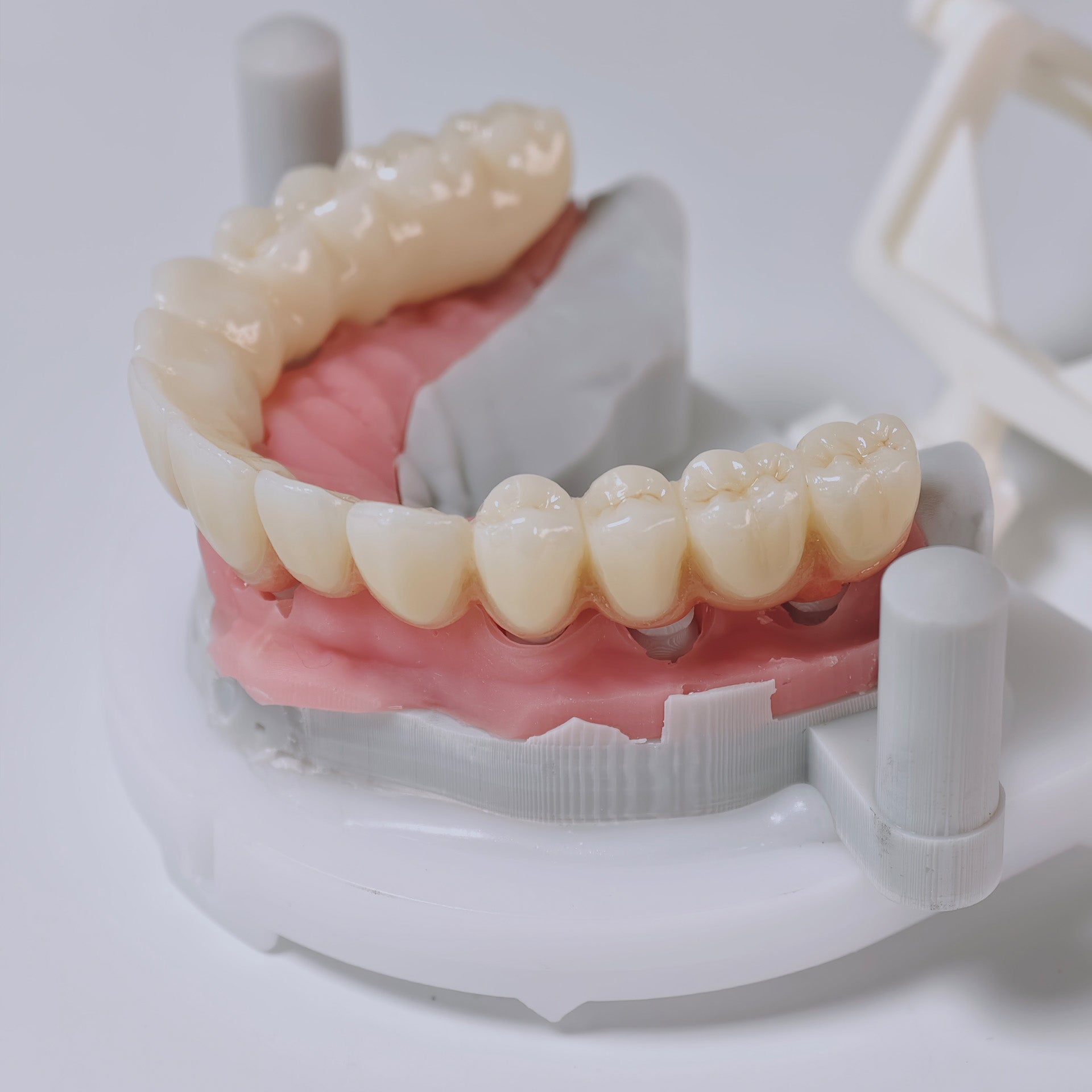 Zirconia Implant Bridges Screwmentable Dental Crown