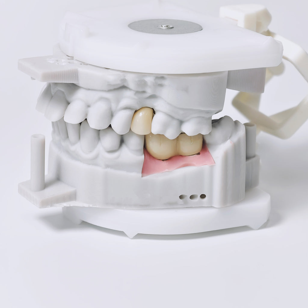 Zirconia Implant Crowns And Bridges Screwmentable Dental Crown