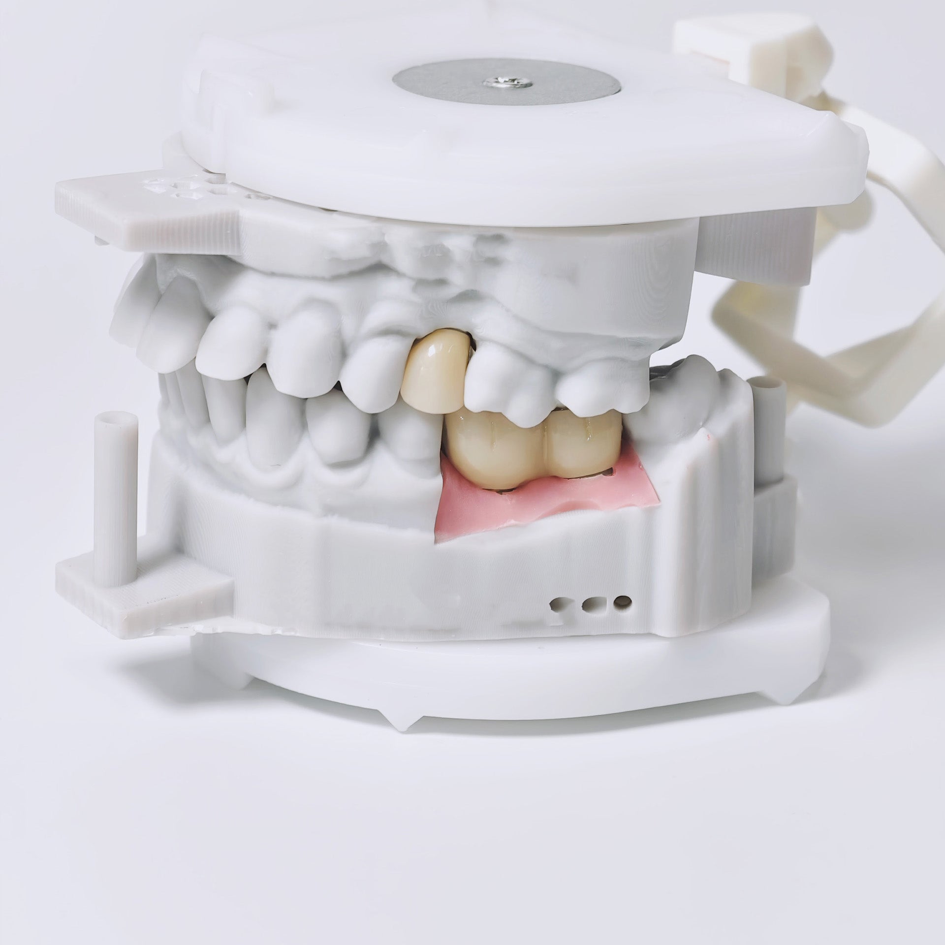 Zirconia Implant Crowns And Bridges Screwmentable Dental Crown