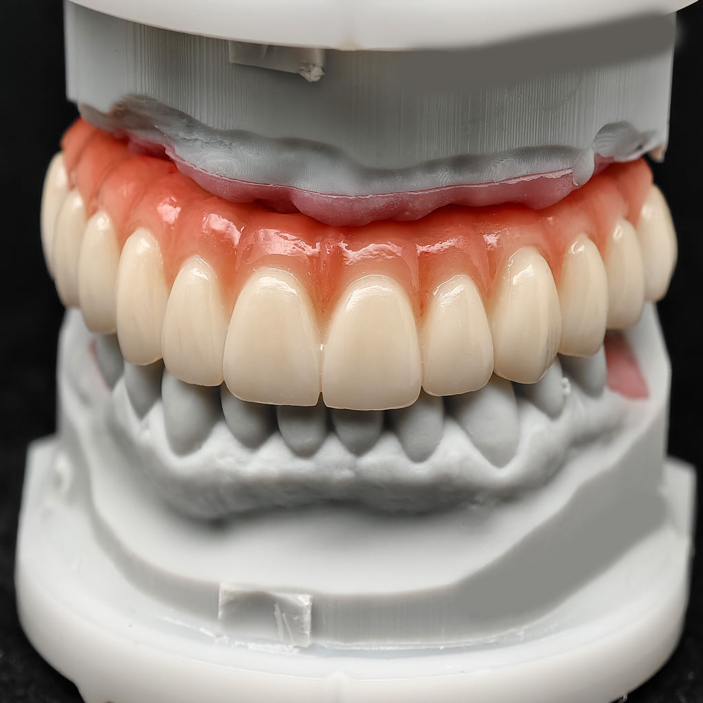 All On 4 Zirconia Bridge With Ti-Base Screw Retained Trying For Full Arch Restoration