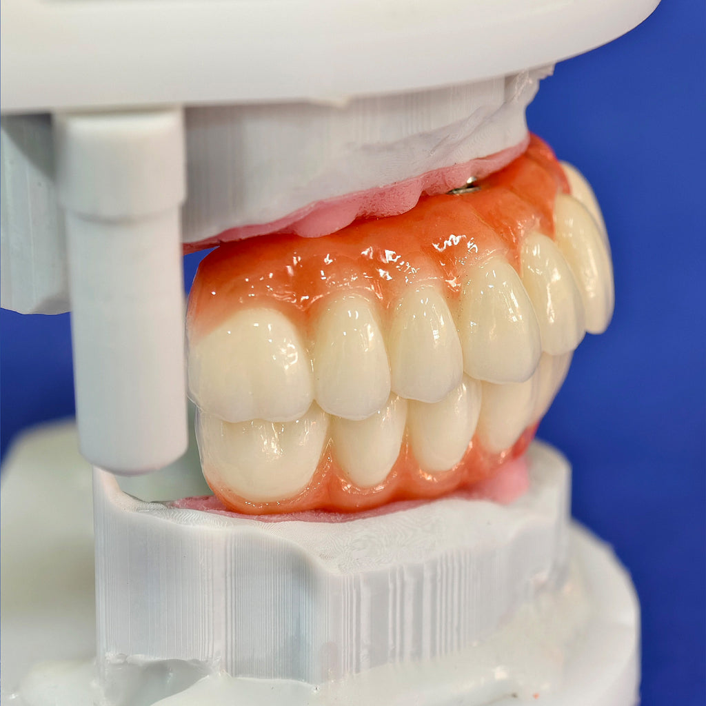 All On 4 Zirconia Bridge With Ti-Base Screw Retained Trying For Full Arch Restoration