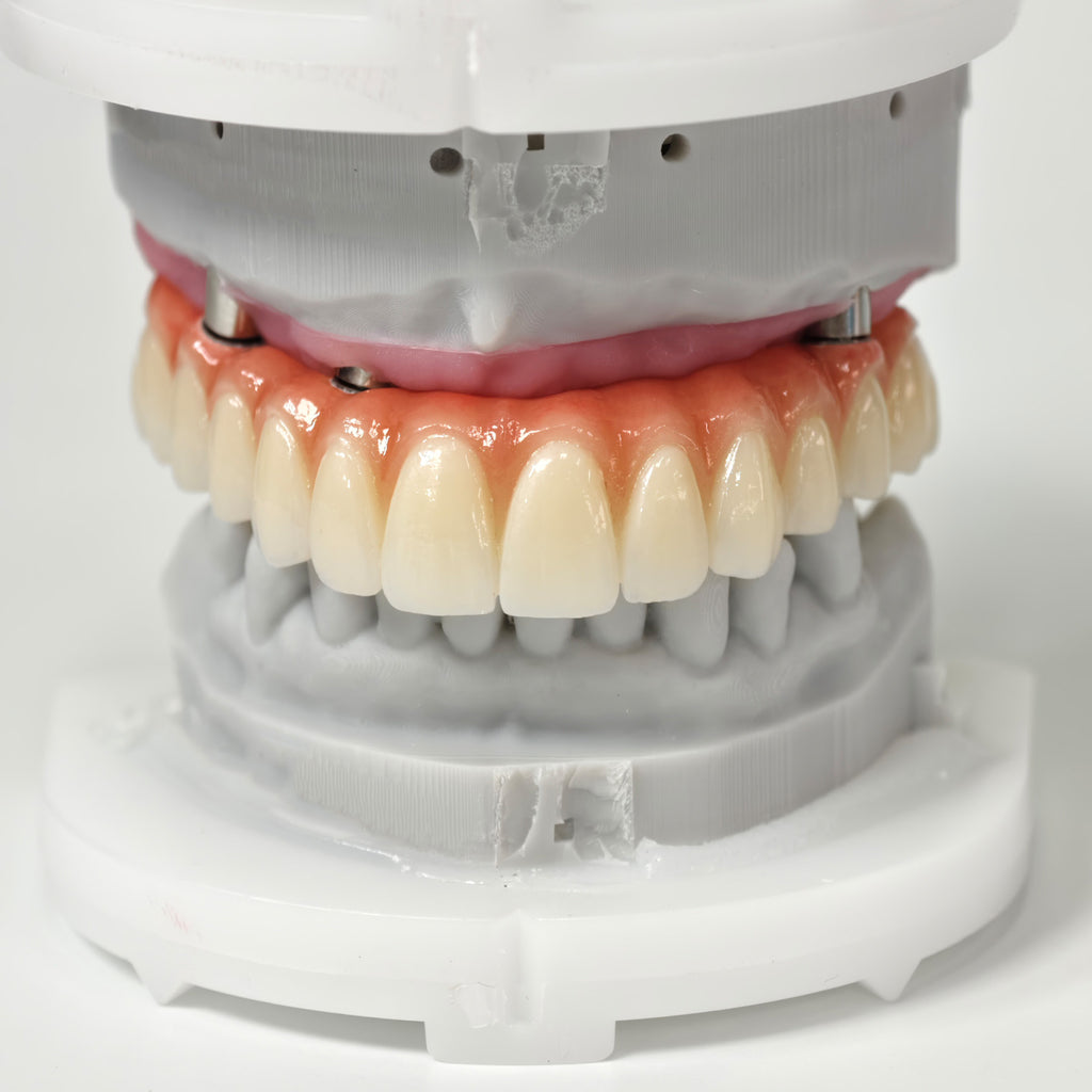 All On 5 Zirconia Bridge With Ti-Base Screw Retained
