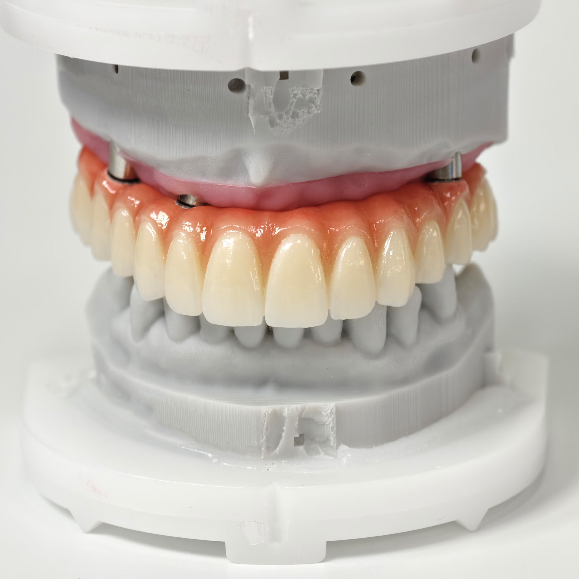All On 5 Zirconia Bridge With Ti-Base Screw Retained