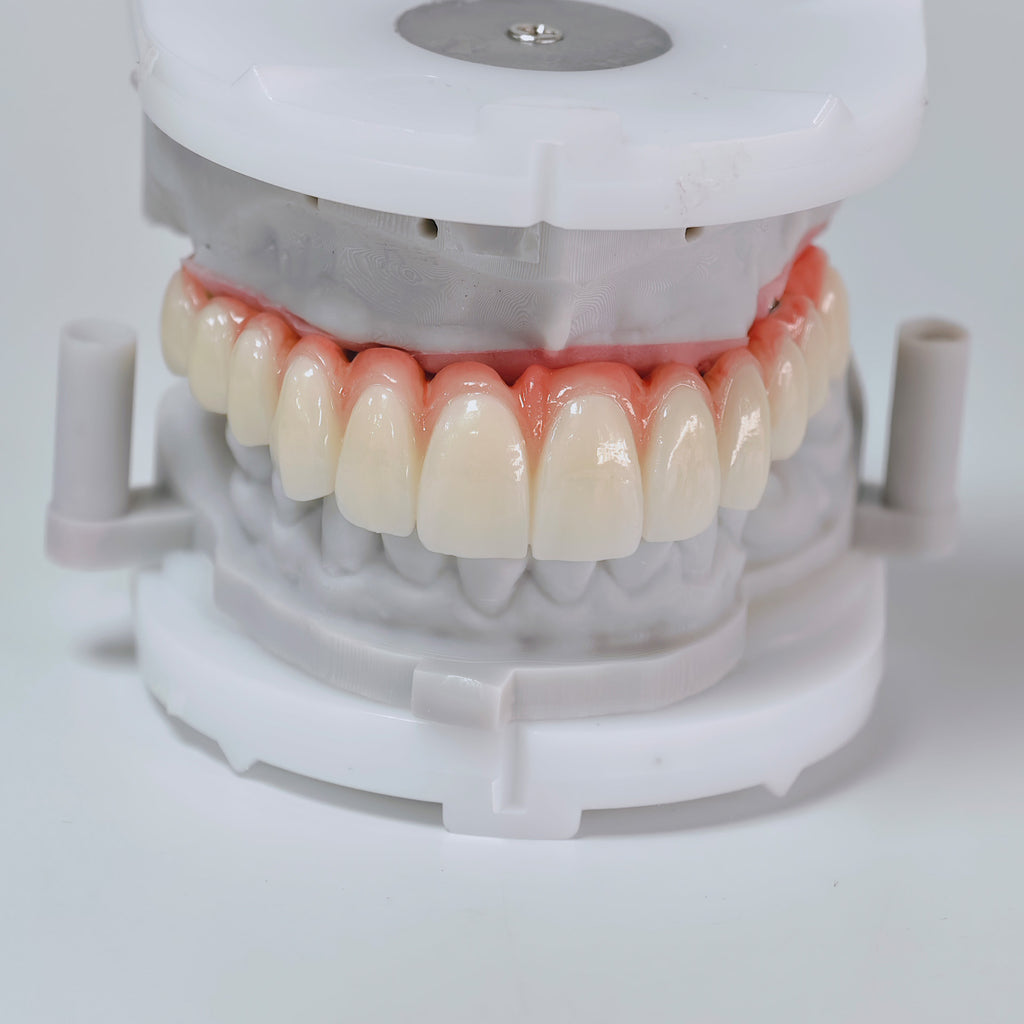 All On 6 Zirconia Bridge With Ti-Base Screw Retained