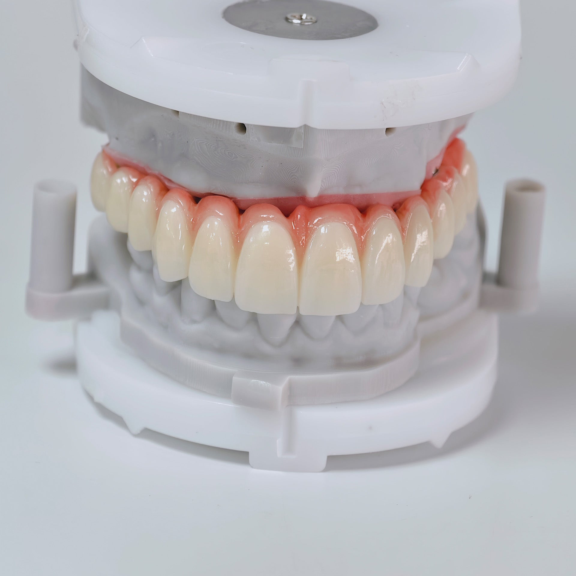 All On 6 Zirconia Bridge With Ti-Base Screw Retained