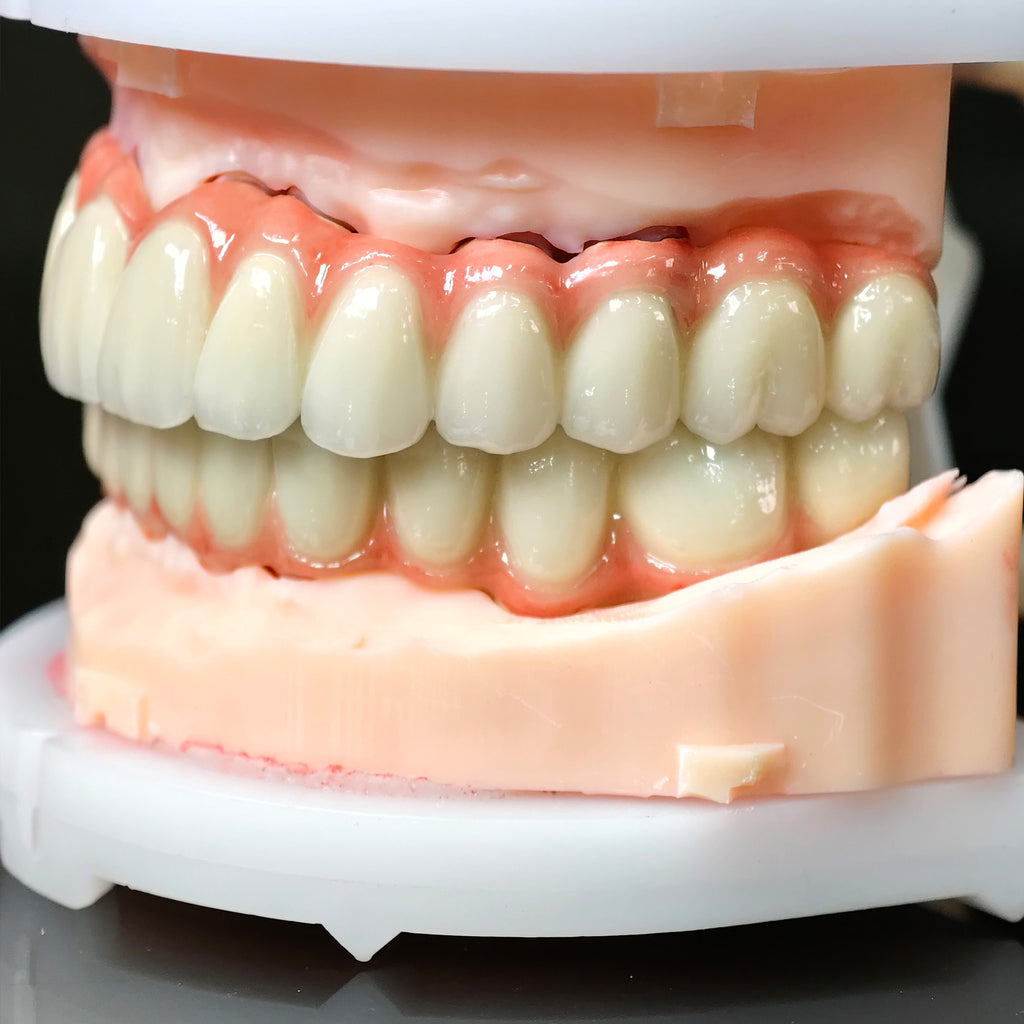 Co - Cr PFM Dental Bridge