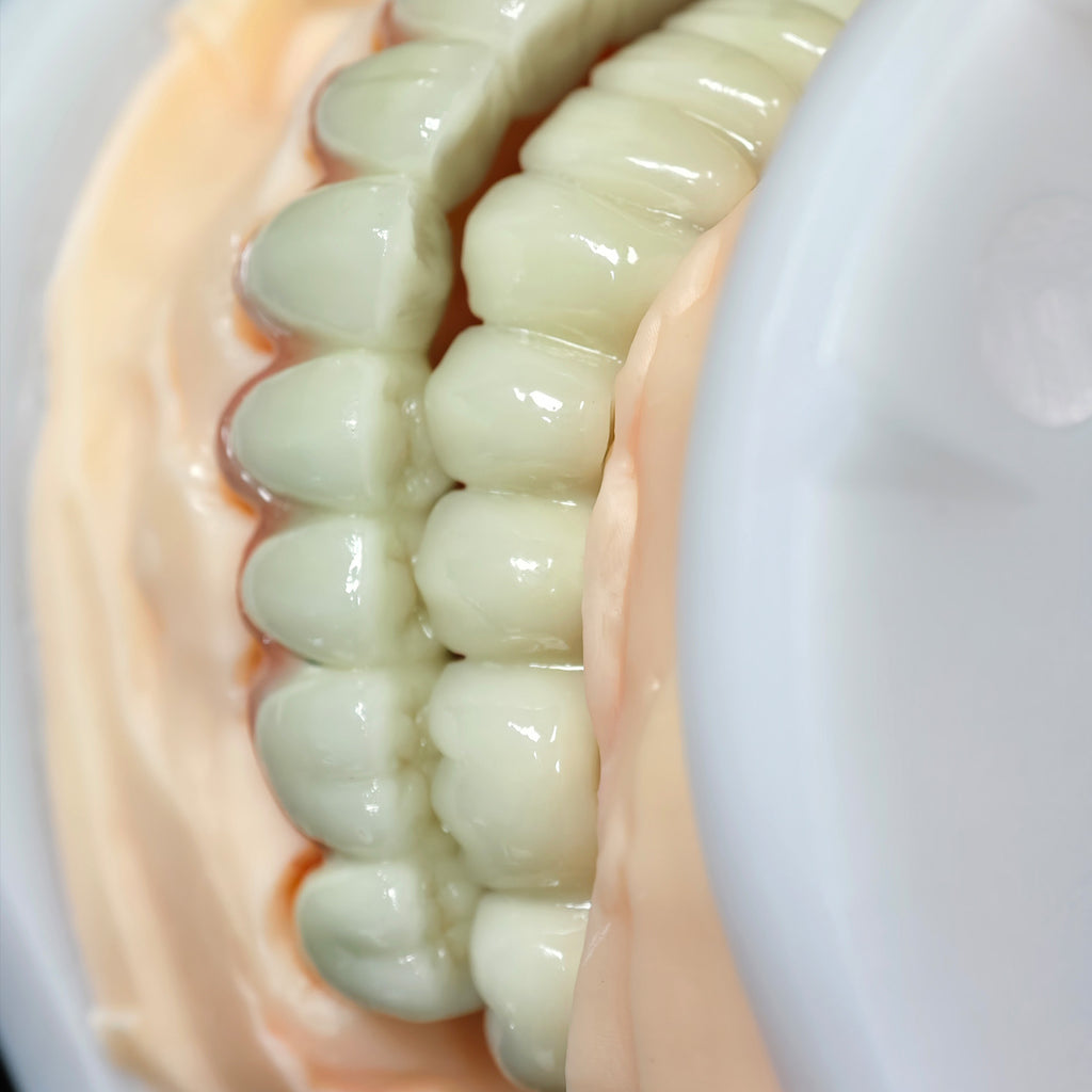 Co - Cr PFM Dental Bridge