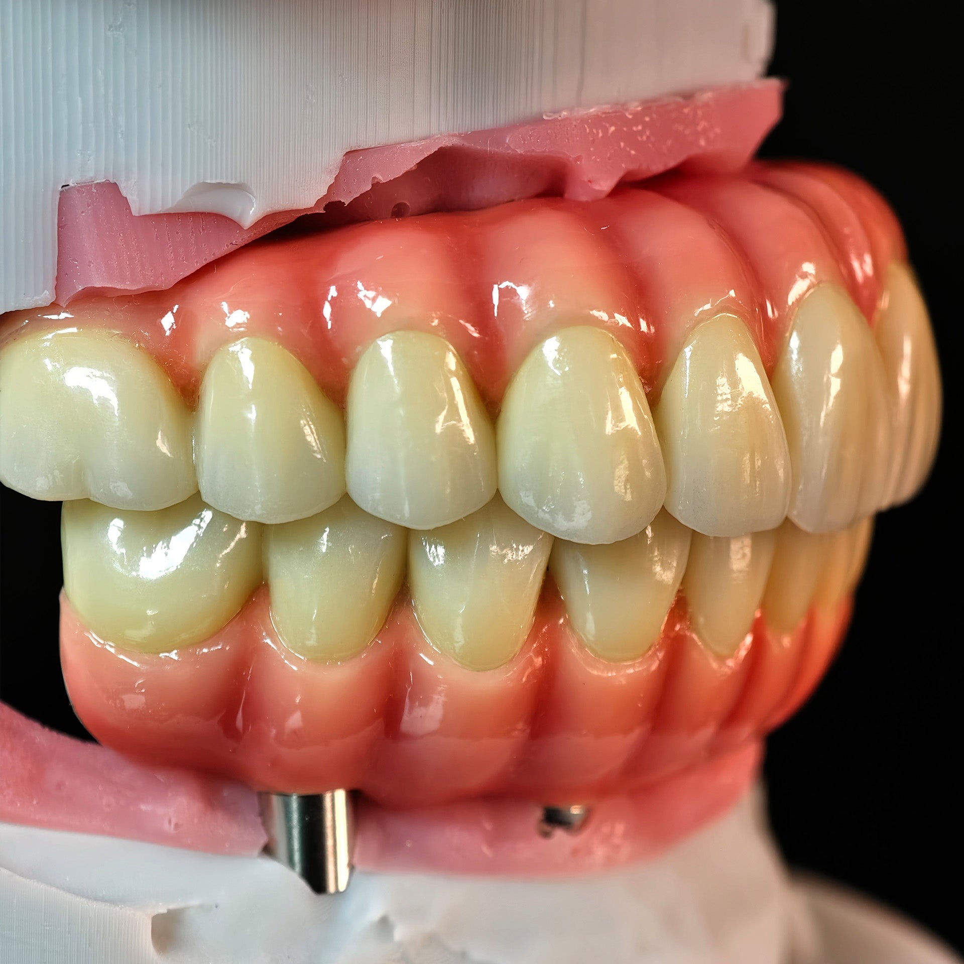 Enhanced Zirconia Crown Malo Bridge